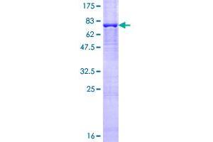 Image no. 1 for TAF6-Like RNA Polymerase II, P300/CBP-Associated Factor (PCAF)-Associated Factor, 65kDa (TAF6L) (AA 1-459) protein (GST tag) (ABIN1322102)
