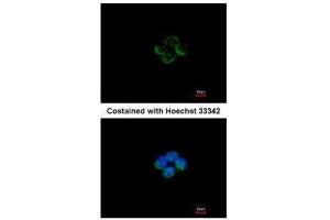 ICC/IF Image Immunofluorescence analysis of methanol-fixed A431, using ACADM, antibody at 1:200 dilution. (Medium-Chain Specific Acyl-CoA Dehydrogenase, Mitochondrial (MCAD) (Center) anticorps)