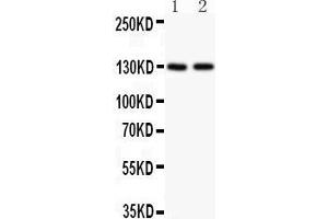 Anti-Hamartin Picoband antibody,  All lanes: Anti Hamartin  at 0. (TSC1 anticorps  (AA 686-884))