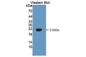 Western Blotting (WB) image for anti-Vasoactive Intestinal Peptide (Vip) (AA 27-157) antibody (ABIN3208742) (Vip anticorps  (AA 27-157))