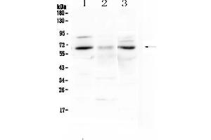 Western blot analysis of CCKBR using anti-CCKBR antibody .