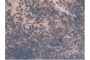 IHC-P analysis of Mouse Spleen Tissue, with DAB staining.