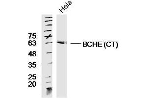Lane 1: HeLa lysates probed with Rabbit Anti-BCHE Polyclonal Antibody, Unconjugated  at 1:300 overnight at 4˚C. (Butyrylcholinesterase anticorps  (AA 505-602))