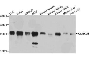 Western blot analysis of extracts of various cell lines, using CSNK2B antibody. (CSNK2B anticorps)