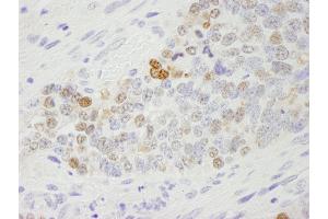 Immunohistochemistry (IHC) image for anti-Importin Subunit alpha-1 (KPNA2) (C-Term) antibody (ABIN7448767) (Importin Subunit alpha-1 (KPNA2) (C-Term) anticorps)