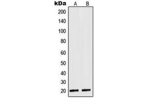 Western blot analysis of NDUFA8 expression in HepG2 (A), MCF7 (B) whole cell lysates. (NDUFA8 anticorps  (Center))