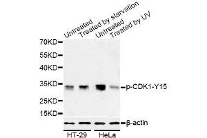 Western blot analysis of extracts of HT-29 and HeLa cells, using Phospho-CDK1-Y15 antibody (ABIN5969877) at 1/1000 dilution. (CDK1 anticorps  (pTyr15))