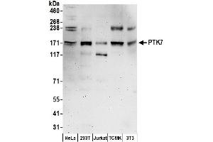 Western Blotting (WB) image for anti-PTK7 Protein tyrosine Kinase 7 (PTK7) (AA 750-800) antibody (ABIN7450618)