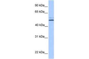 Western Blotting (WB) image for anti-Na+/H+ Exchanger Domain Containing 2 (NHEDC2) antibody (ABIN2463557) (NHEDC2 anticorps)