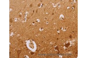 anti-Cholesterol Esterase (CEL) antibody