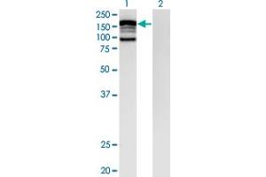 Western Blot analysis of CLIP2 expression in transfected 293T cell line by CLIP2 monoclonal antibody (M07), clone 3H5. (CLIP2 anticorps  (AA 946-1046))