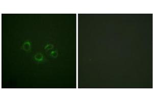 Immunofluorescence analysis of A549 cells, using EPHA2/3/4 (epitope around residue 588/596) antibody. (EPHA2/3/4 anticorps  (Tyr588, Tyr596))