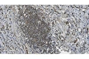 IHC analysis of PARP using anti-PARP antibody (ABIN7602278). (PARP1 anticorps  (AA 670-858))