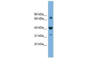 Western Blot showing VPS16 antibody used at a concentration of 1-2 ug/ml to detect its target protein. (VPS16 anticorps  (Middle Region))