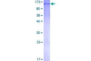Image no. 1 for Mutated in Colorectal Cancers (MCC) (AA 1-829) protein (GST tag) (ABIN1310523)
