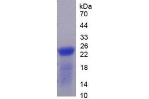 SDS-PAGE of Protein Standard from the Kit (Highly purified E. (Thrombospondin 1 Kit ELISA)