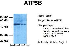 Host:  Rabbit  Target Name:  ATP5B  Sample Tissue:  Human Fetal Liver, Human Fetal Lung, Human Ovary Tumor, Human 786-0  Antibody Dilution:  1.
