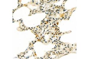 Immunohistochemistry of paraffin embedded mouse lung using SIX1 (ABIN7075617) at dilution of 1: 650 (400x lens) (SIX Homeobox 1 anticorps)