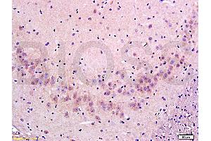 Formalin-fixed and paraffin embedded: rat brain tissue labeled with Anti-FLIP/c FLIP Polyclonal Antibody (ABIN725255), Unconjugated at 1:300 followed by conjugation to the secondary antibody and DAB staining (FLIP anticorps  (AA 7-100))