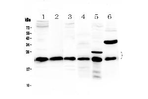 Western blot analysis of PARK7 / DJ1 using anti-PARK7 / DJ1 antibody .