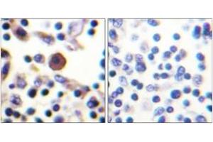 Immunohistochemistry (IHC) image for anti-Interleukin 9 Receptor (IL9R) (AA 472-521) antibody (ABIN2888887) (IL9 Receptor anticorps  (AA 472-521))