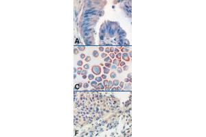 TLR9 Immunohistochemistry.