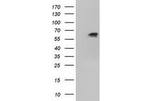 Image no. 5 for anti-Insulin-Like Growth Factor 2 mRNA Binding Protein 2 (IGF2BP2) antibody (ABIN1498822) (IGF2BP2 anticorps)