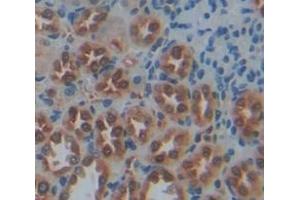 IHC-P analysis of Rat Tissue, with DAB staining. (TKT anticorps  (AA 1-286))