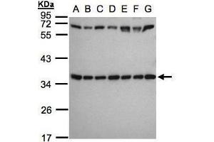 WB Image Sample(30 ug whole cell lysate) A: 293T B: A431 , C: H1299 D: HeLa S3 , E: Hep G2 , F: MOLT4 , G: Raji , 12% SDS PAGE antibody diluted at 1:1000 (RPS3A anticorps)