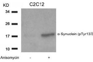Image no. 2 for anti-Synuclein, alpha (SNCA) (pTyr133) antibody (ABIN401575) (SNCA anticorps  (pTyr133))