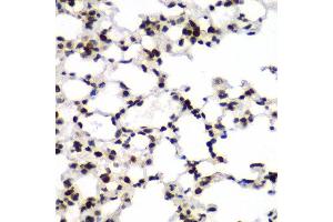 Immunohistochemistry of paraffin-embedded mouse lung using TEAD1 antibody at dilution of 1:100 (x40 lens). (TEAD1 anticorps)