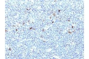 Formalin-fixed, paraffin-embedded human tonsil stained with HLA-Aw32 / HLA-A25 antibody (CATA-1). (HLA-Aw32-&-HLA-A25 (MHC-I) anticorps)