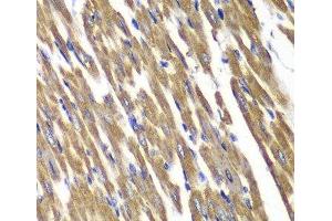 Immunohistochemistry of paraffin-embedded Rat heart using SDHA Polyclonal Antibody at dilution of 1:100 (40x lens). (SDHA anticorps)
