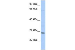 WB Suggested Anti-TGIF2LX Antibody Titration:  0. (TGIF2LX anticorps  (Middle Region))