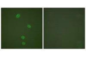 Immunofluorescence analysis of HepG2 cells, using MCM5 antibody. (MCM5 anticorps)