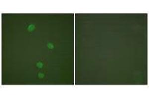 Immunofluorescence analysis of HepG2 cells, using MCM5 antibody. (MCM5 anticorps)