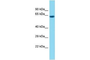 Host: Rabbit Target Name: C1orf94 Sample Type: Fetal Heart lysates Antibody Dilution: 1. (C1ORF94 anticorps  (C-Term))