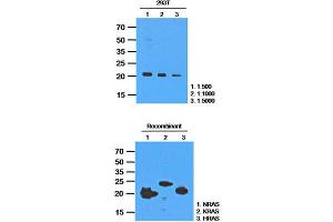 Western Blotting (WB) image for anti-GTPase NRas (NRAS) antibody (ABIN781533)
