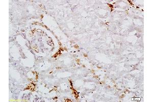 Formalin-fixed and paraffin embedded mouse kidney labeled with Anti AAK1 Polyclonal Antibody, Unconjugated  at 1:200 followed by conjugation to the secondary antibody and DAB staining