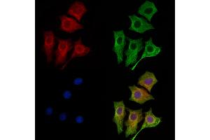 ABIN6261731 and ABIN6269136 staining HepG2 cells by IF/ICC. (FGFR1 anticorps  (C-Term))