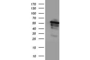 Western Blotting (WB) image for anti-Cytochrome P450, Family 2, Subfamily A, Polypeptide 6 (CYP2A6) antibody (ABIN1497722)