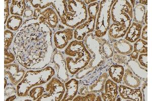 ABIN6278524 at 1/100 staining Mouse kidney tissue by IHC-P.