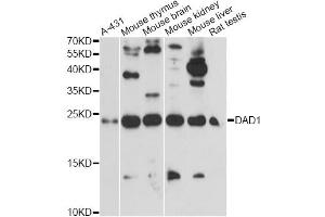 Western blot analysis of extracts of various cell lines, using DAD1 antibody. (DAD1 anticorps)