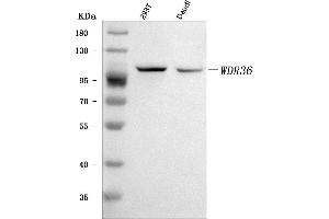Western blot analysis of WDR36 using anti-WDR36 antibody (ABIN7602409). (WDR36 anticorps  (AA 74-865))