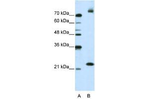WB Suggested Anti-FZD9 Antibody Titration:  2.