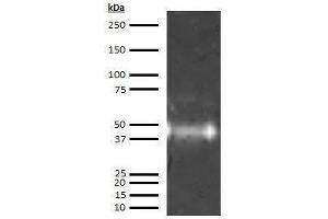 Western Blotting (WB) image for anti-Orosomucoid 1 (ORM1) antibody (ABIN613603) (ORM1 anticorps)
