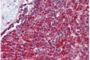 Human Spleen: Formalin-Fixed, Paraffin-Embedded (FFPE)