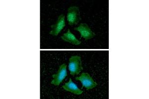 ICC/IF analysis of PPP1CA in HeLa cells line, stained with DAPI (Blue) for nucleus staining and monoclonal anti-human PPP1CA antibody (1:100) with goat anti-mouse IgG-Alexa fluor 488 conjugate (Green). (PP1 /PPP1CA (AA 30-299), (Catalytic Subunit) anticorps)