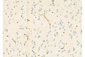 ABIN6265129 and ABIN6273163 at 1/100 staining Rat brain tissue by IHC-P. (SLC38A3 anticorps  (Internal Region))
