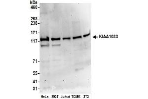 anti-WASH Complex Subunit 4 (WASHC4) (AA 1123-1173) antibody